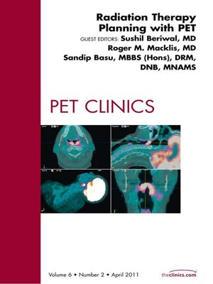 cover image of Radiation Therapy Planning, an Issue of PET Clinics